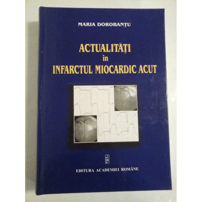 ACTUALITATI in  INFARCTUL  MIOCARDIC  ACUT  -  MARIA  DOROBANTU 